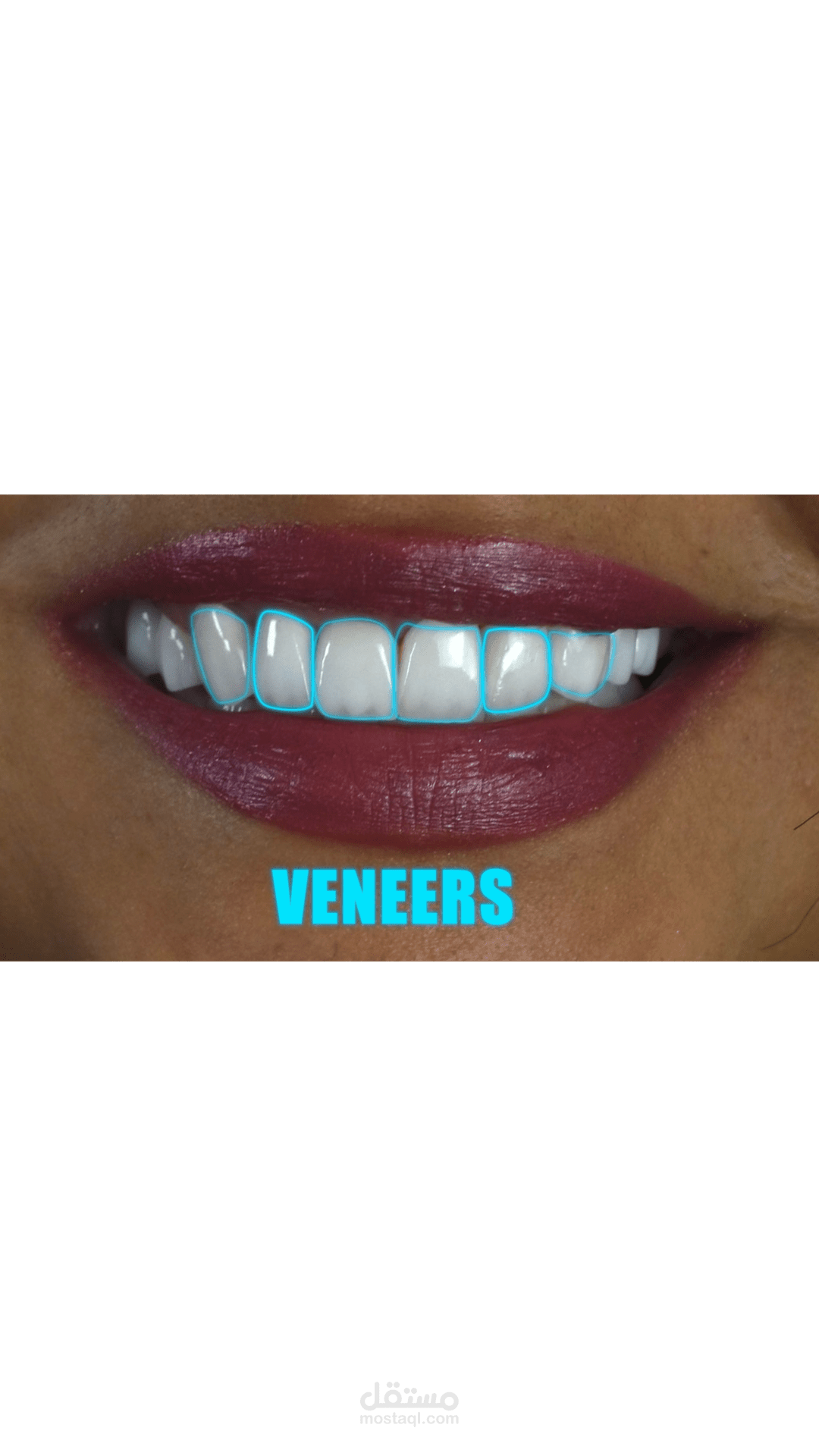 Dental Motion Graphic | Animation that Makes You Smile #dentistry #dentist #dental_motion_graphic