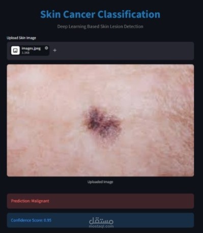 Sin_cancer_project