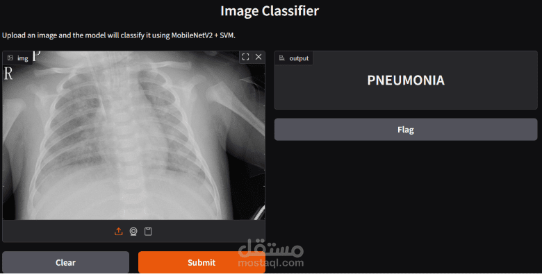نموذج ذكي للكشف عن الالتهاب الرئوي من صور الأشعة باستخدام OpenCV وتعلم الآلة