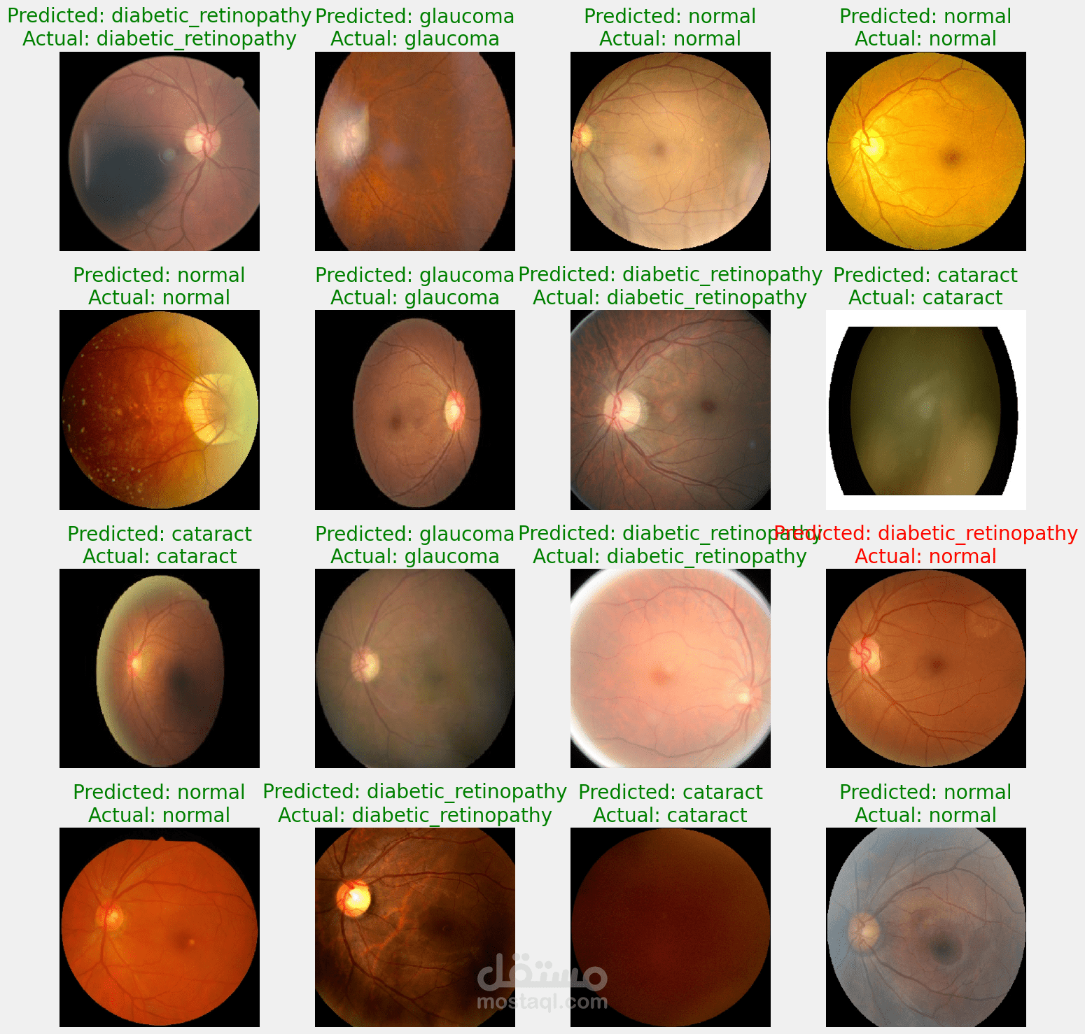 ?️ تصنيف أمراض العين باستخدام CNN و EfficientNetB3