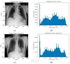 Developed an intelligent chest disease classification system using X-ray images, leveraging artificial