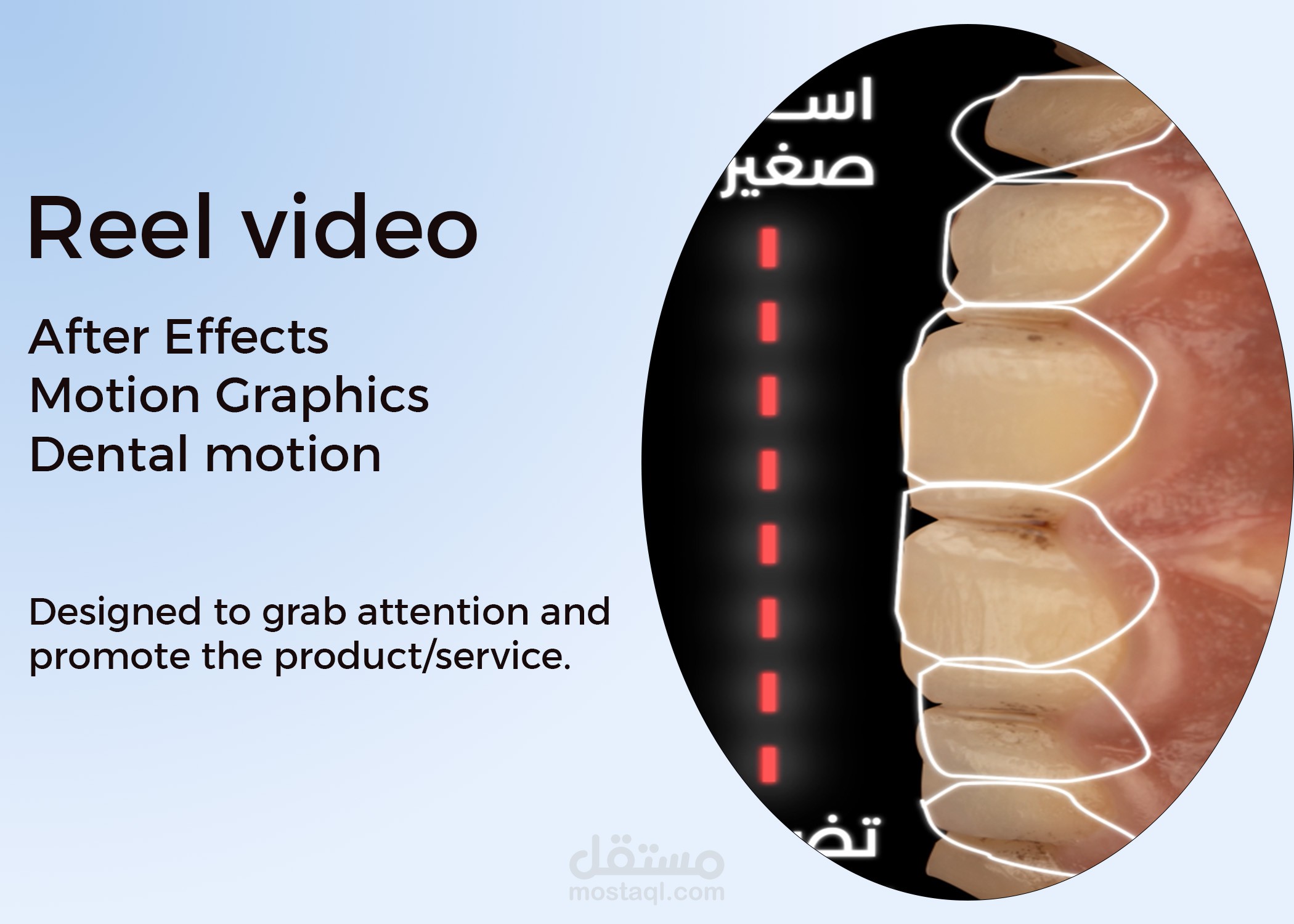 reel dental motion grahic