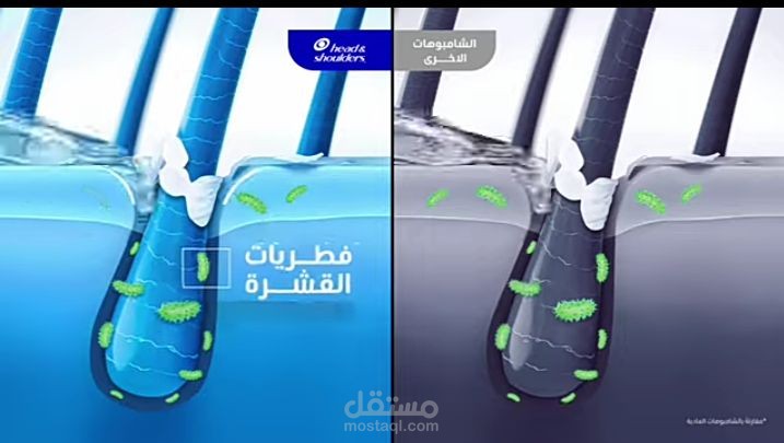 اعلان عن مزيل للقشرة
