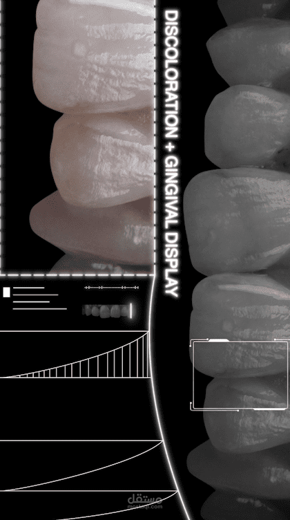 Dental Motion Graphic