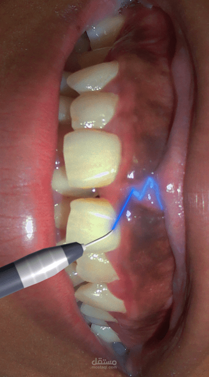 Dental Motion Cases