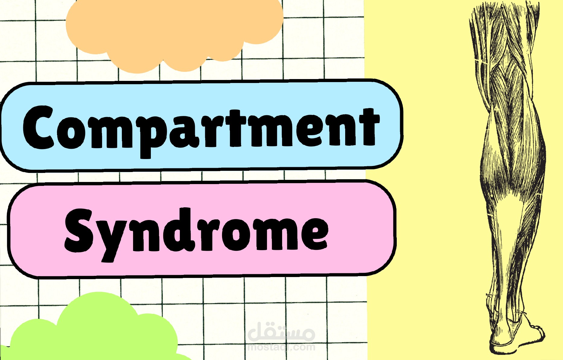 Compartment syndrome
