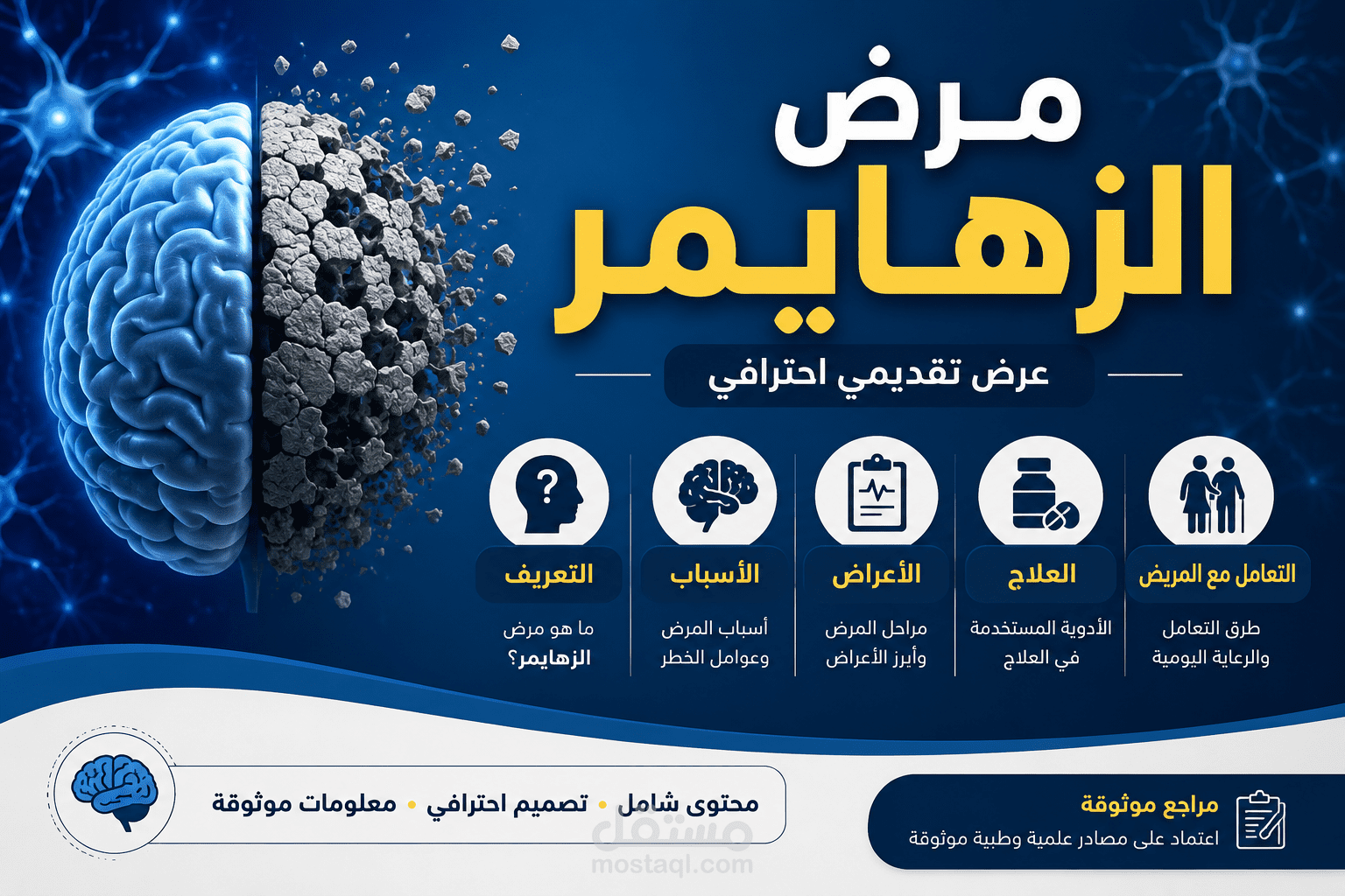 بوربوينت شامل عن مرض الزهايمر باللغة الإنجليزية