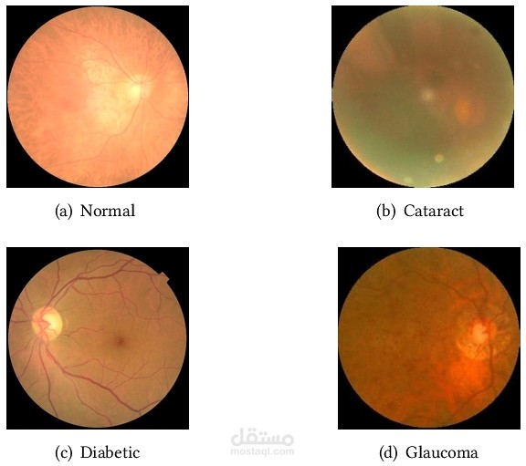eye_disease_classification