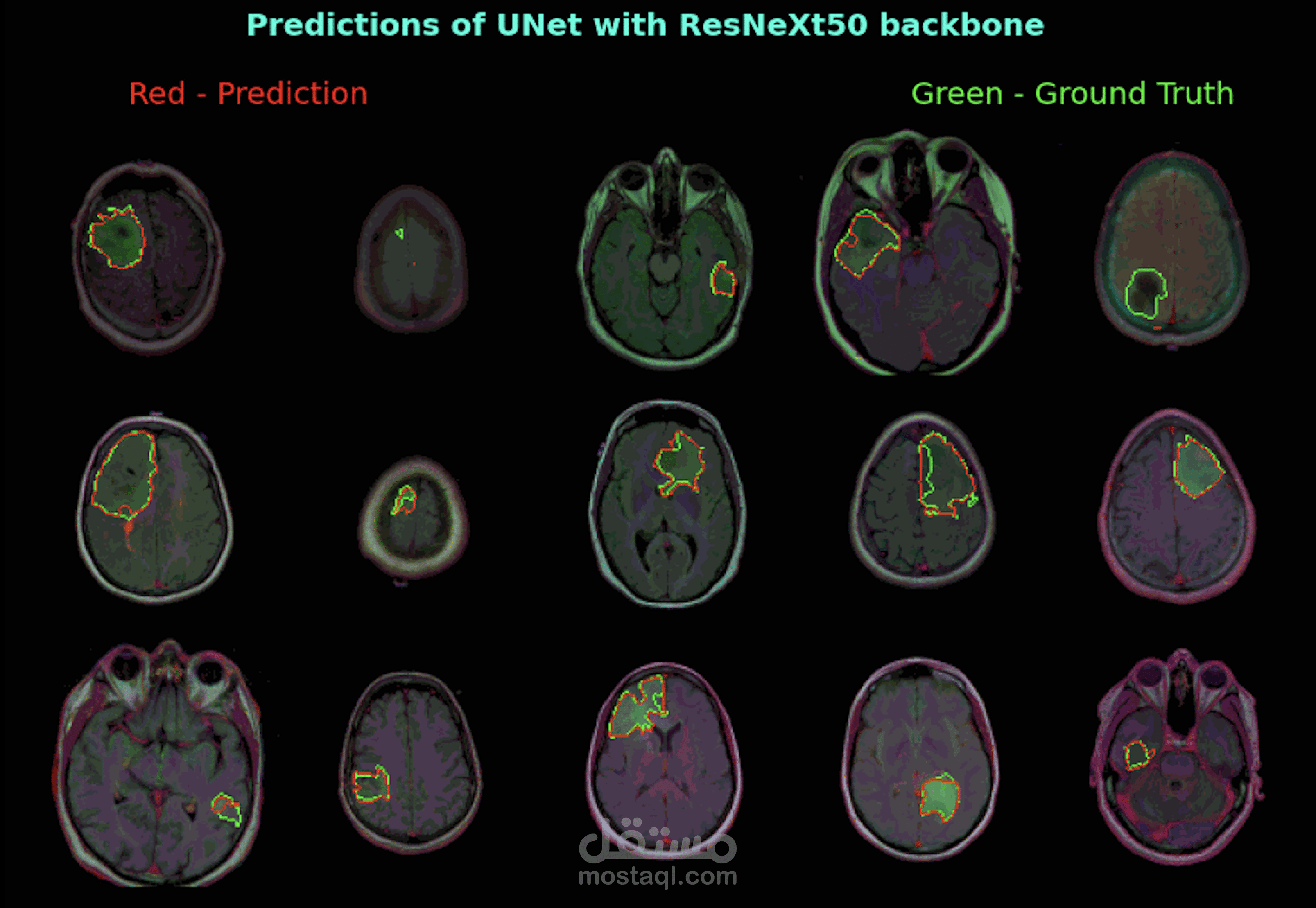 تطوير نموذج ذكاء اصطناعي لتجزئة صور الدماغ بالرنين المغناطيسي (Brain MRI Segmentation Project)