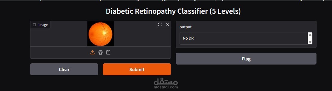Diabetic Retinopathy Detection – Hybrid CNN & Transfer Learning
