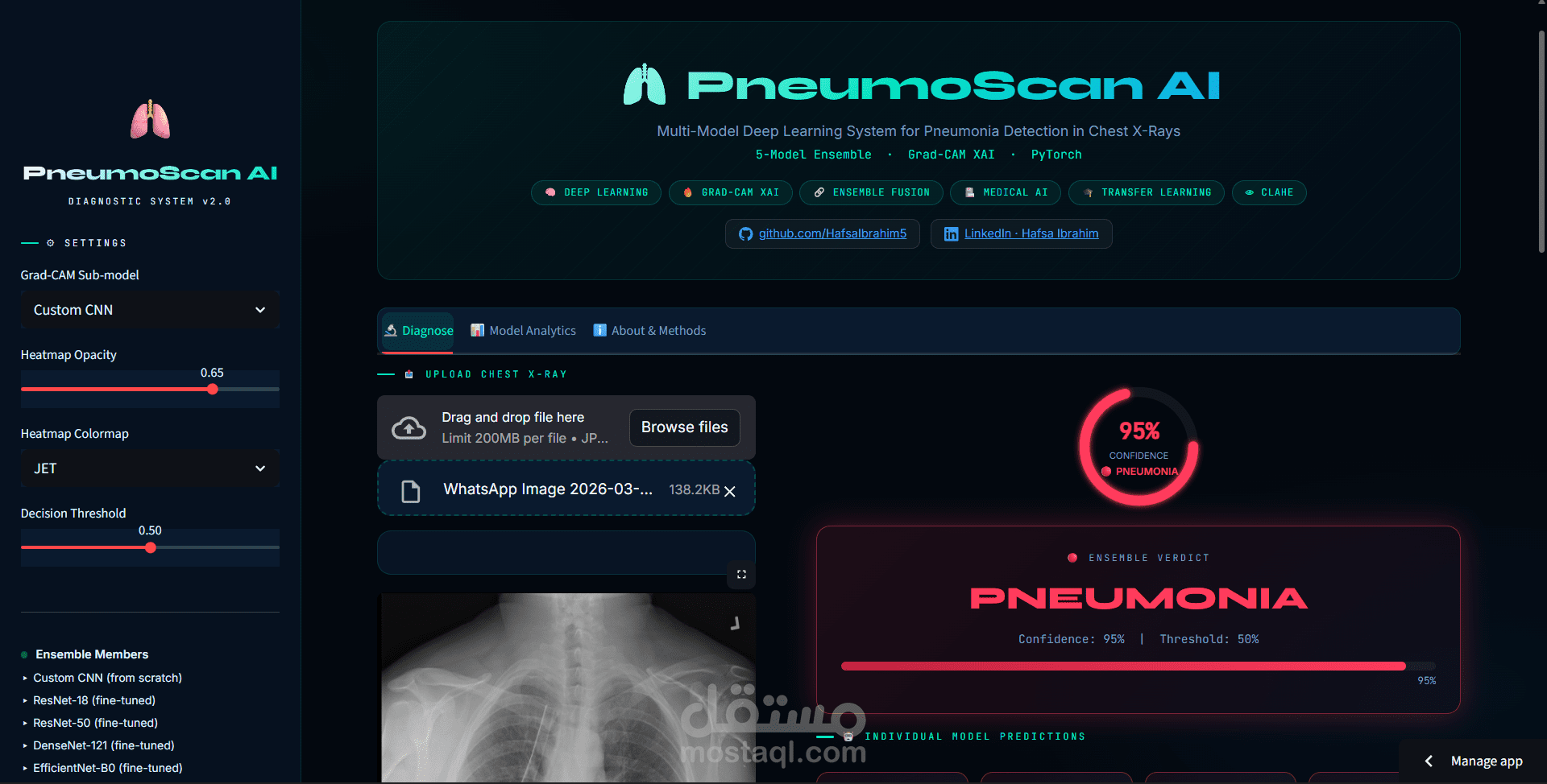 PneumoScan AI: نظام ذكي للكشف عن الالتهاب الرئوي بدقة 97%