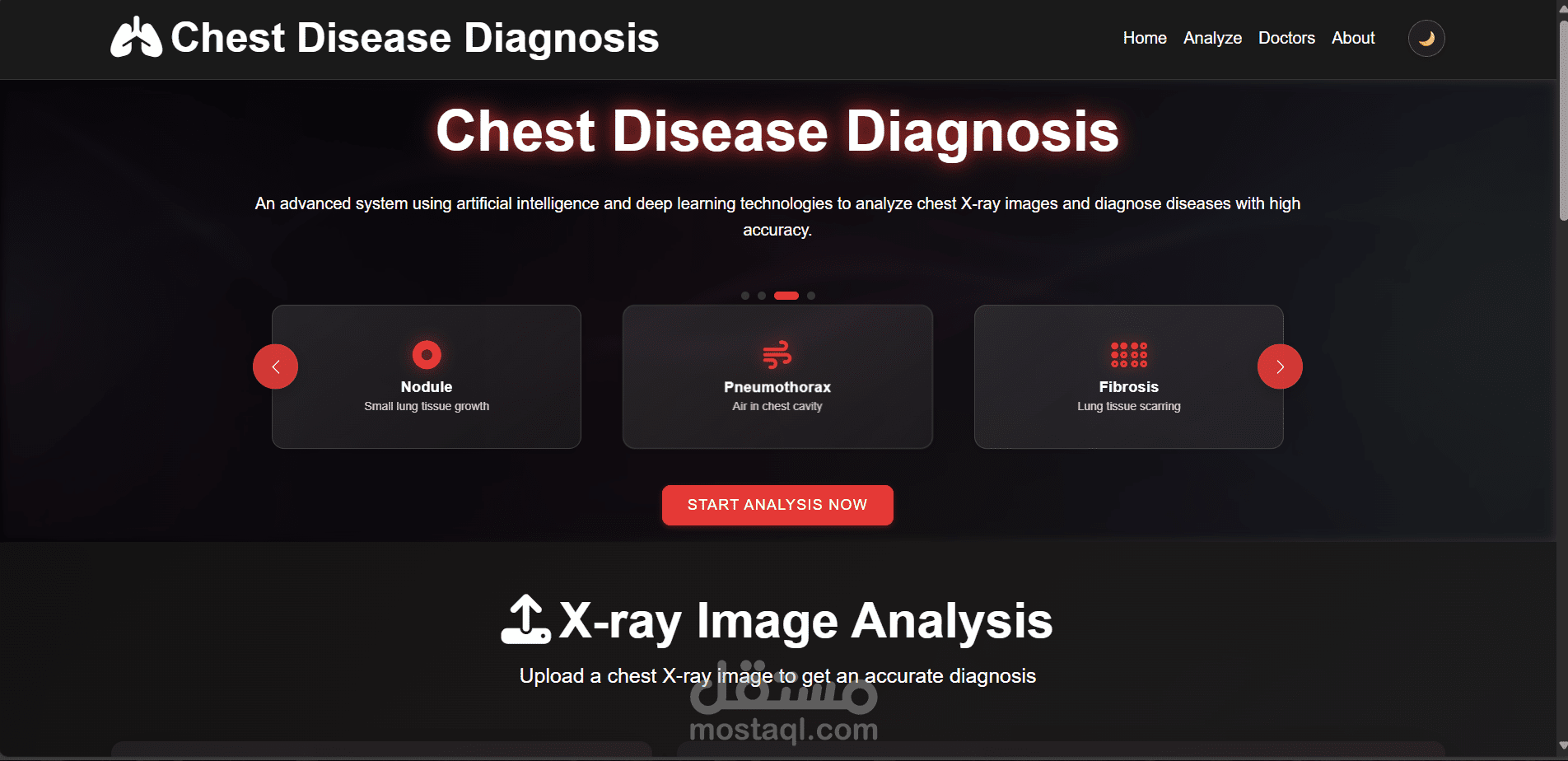 AI-based diagnosis of chest radiology