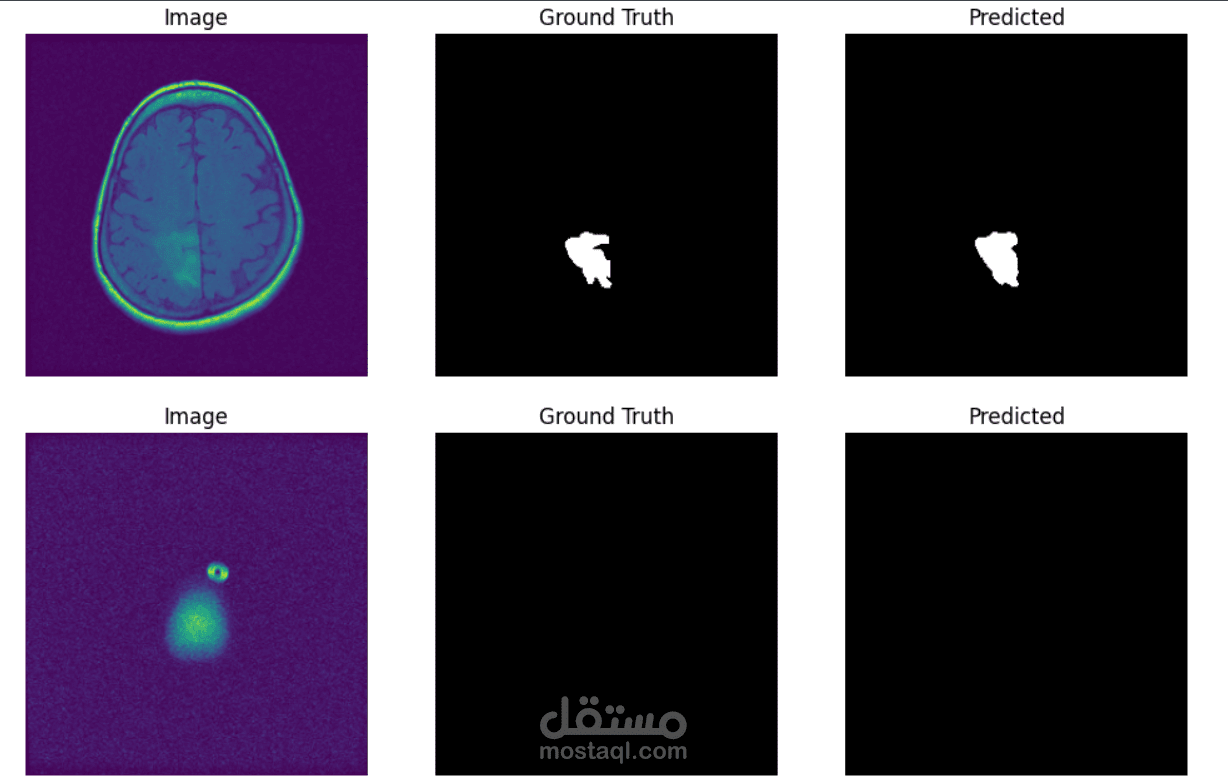 Brain-Tumor-Segmentation-using-U-Net