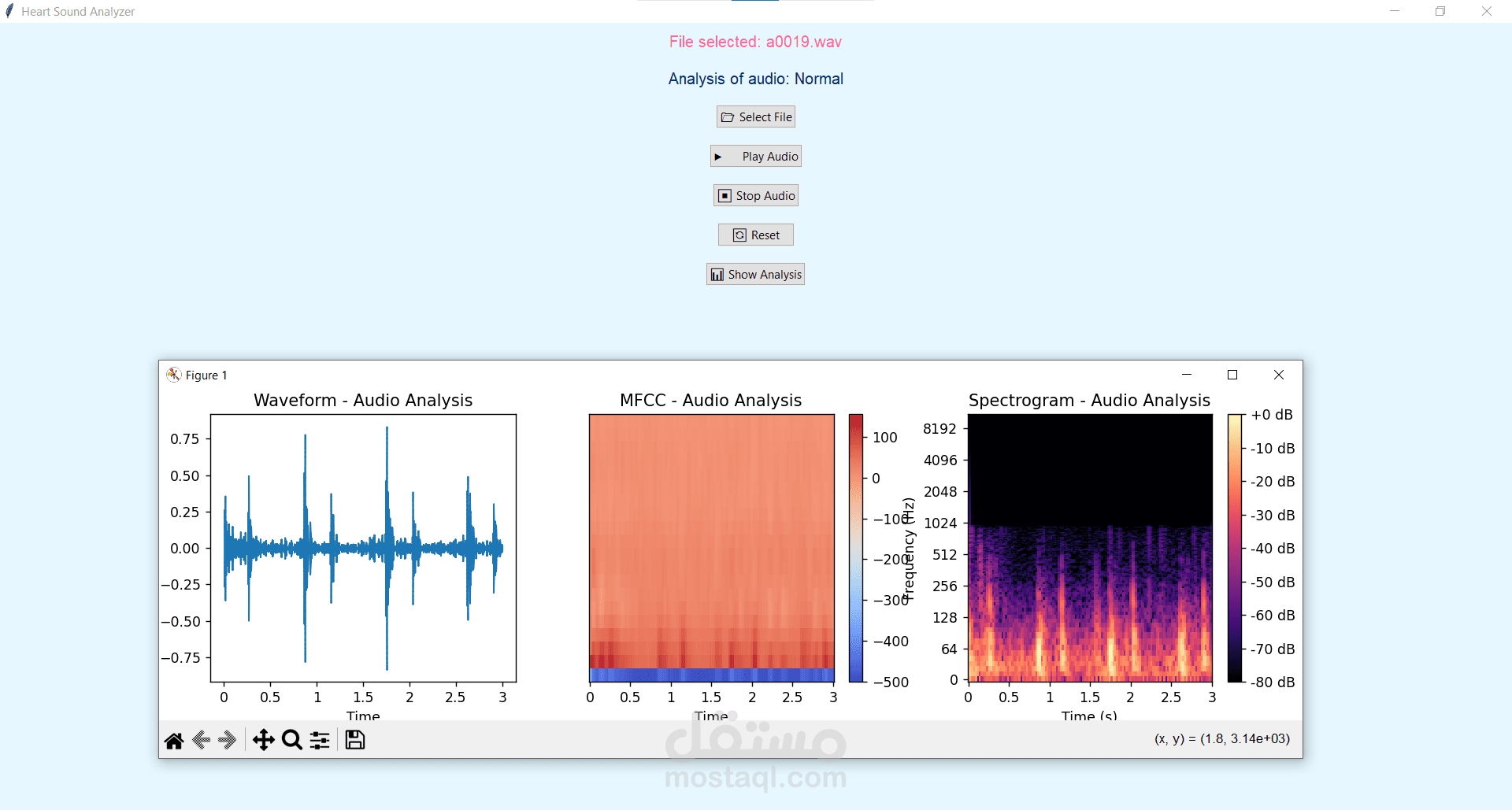 Classification of Heartbeat Sounds