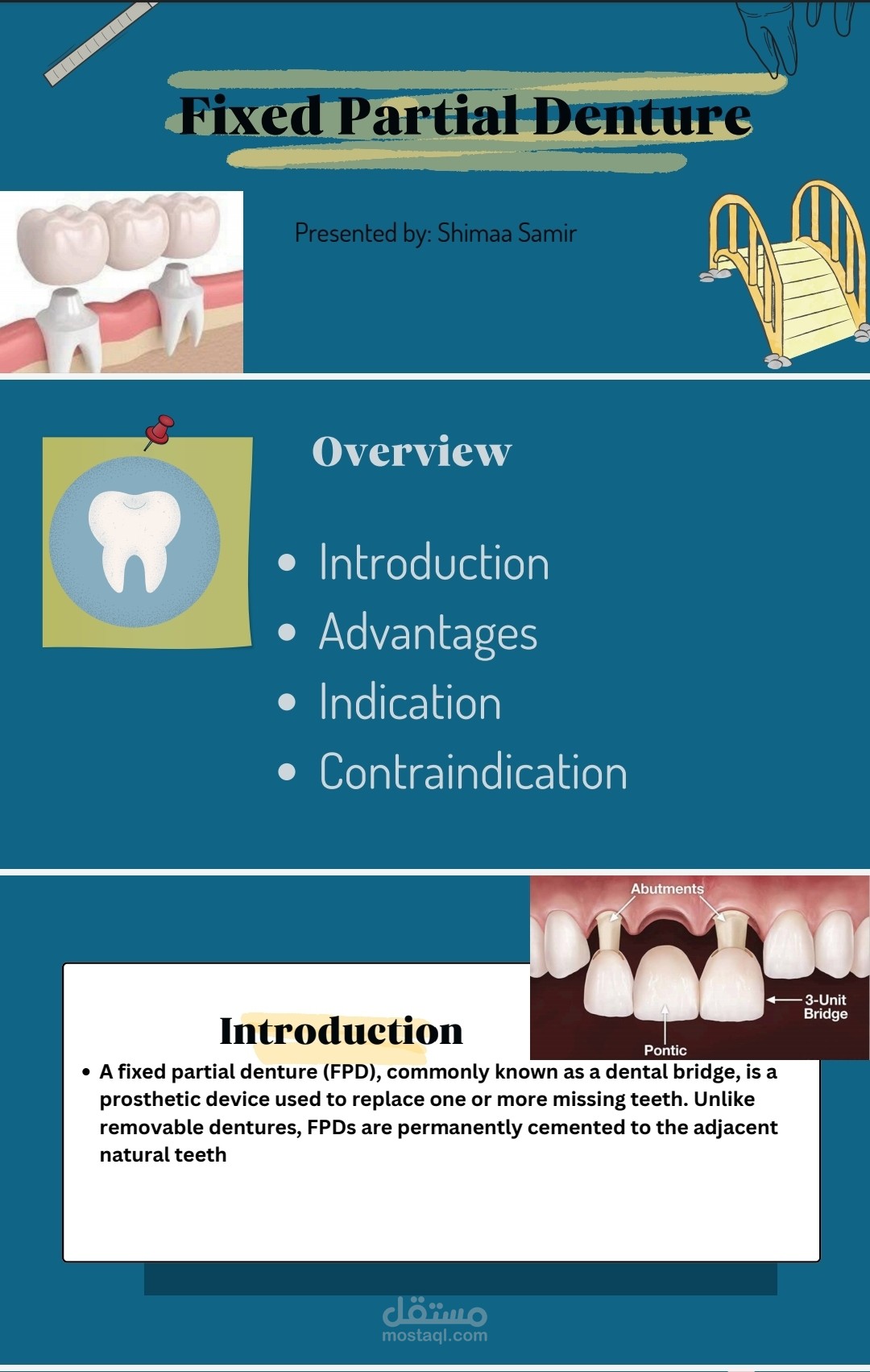 عرض power point عن تركيبات الأسنان الثابتة +pdf عن الإنطباعات الرقمية الخاصة بالأسنان