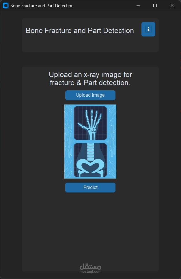 Bone Fracture and Part Detection