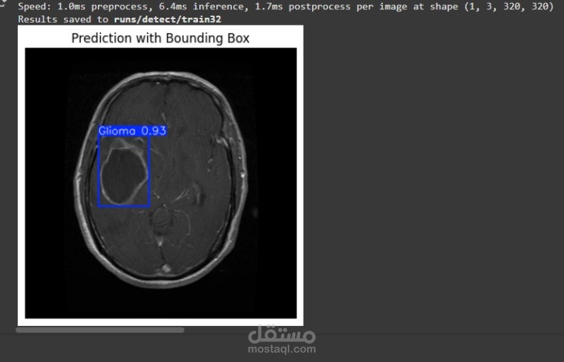 Brain tumor detection