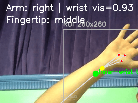 Arm Pulse Point Detection
