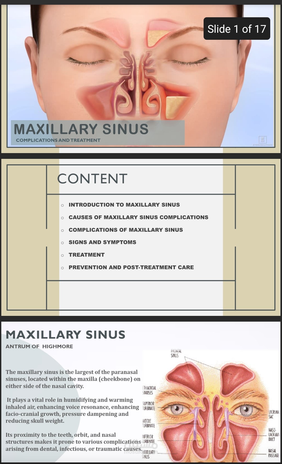 Maxillary sinus and its complications PPT
