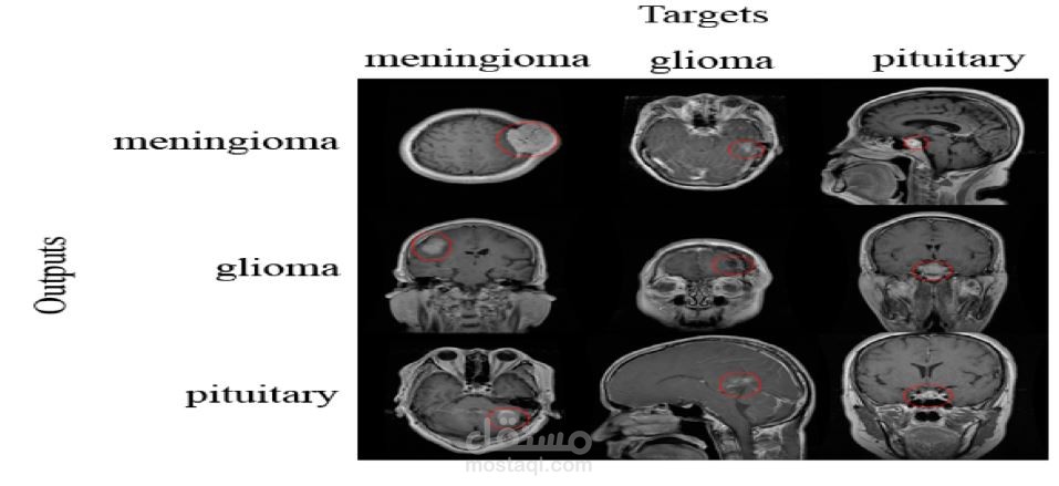 Brain tumor classification and segmentation