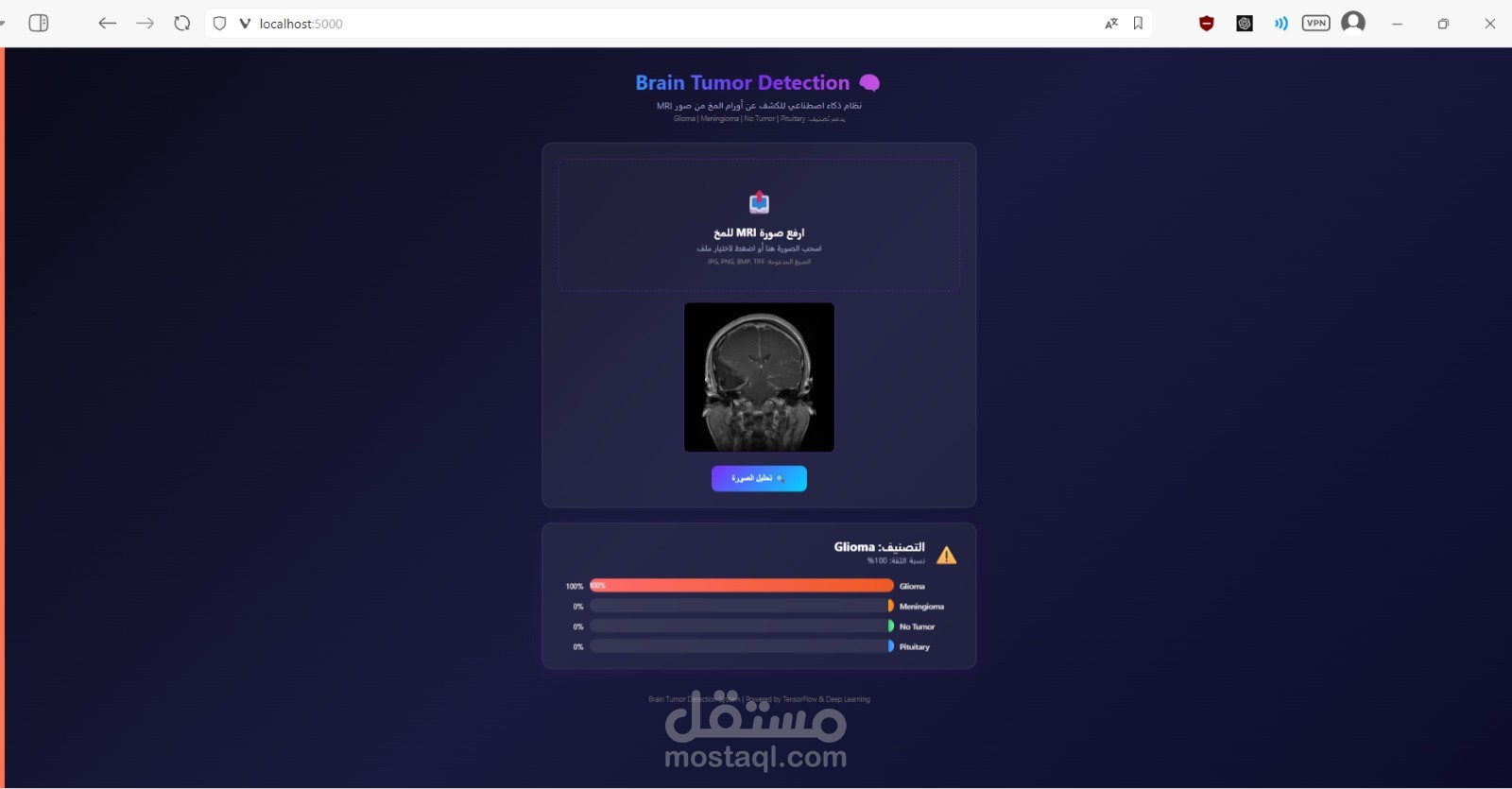 نظام ذكاء اصطناعي طبي لاكتشاف وتصنيف أورام الدماغ باستخدام التعلم العميق