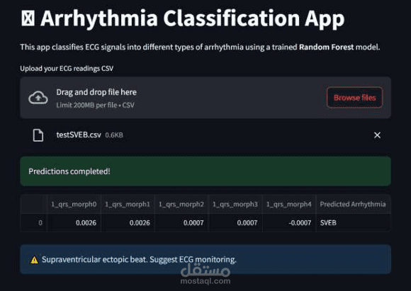Arrhythmia Classification App - تطبيق تصنيف مرض عدم انتظام ضربات القلب