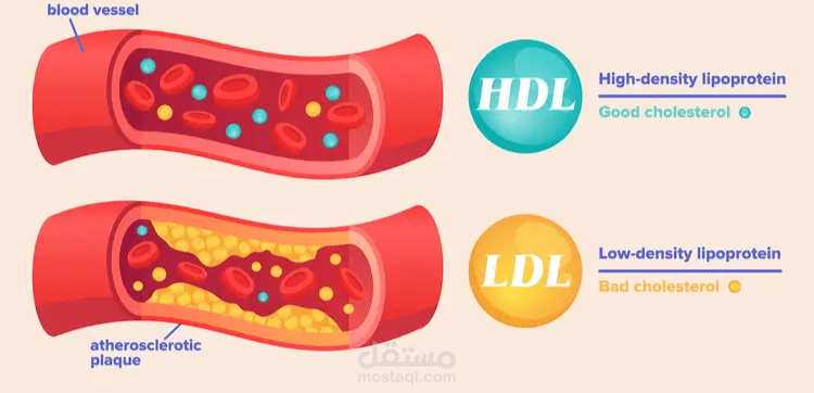 التنبؤ بمستويات الكوليسترول الضار (LDL)
