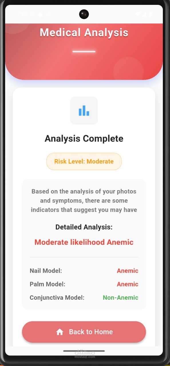 Anemia Dtection App from eyes, Palm and Fingernails