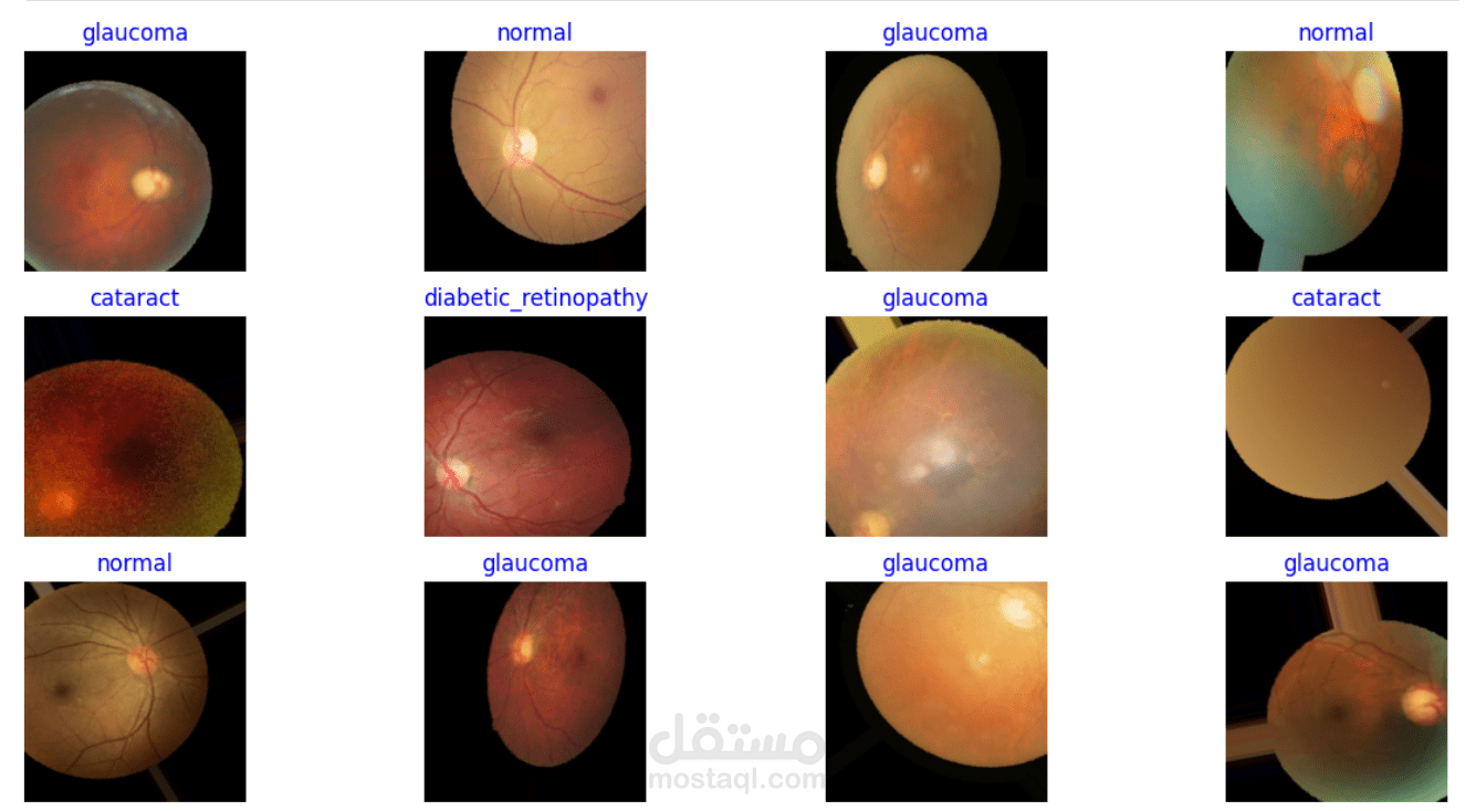 Eye Diseases Classification