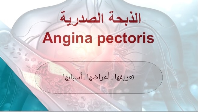 نشرة توعوية ـ الذبحة الصدرية