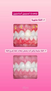 Different Between healthy gums and infectid
