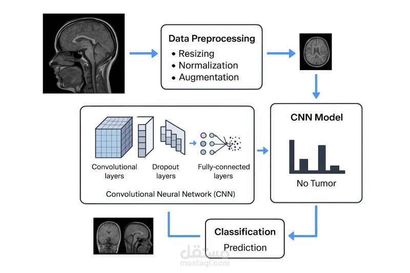 Brain Tumor Classifier