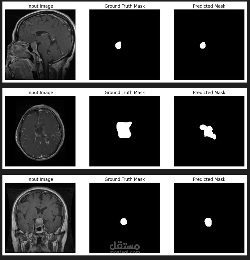 Brain Tumor Detection