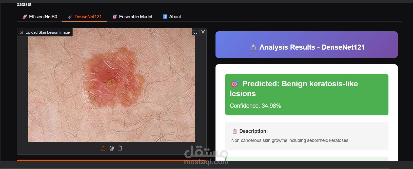 skin-cancer-detection