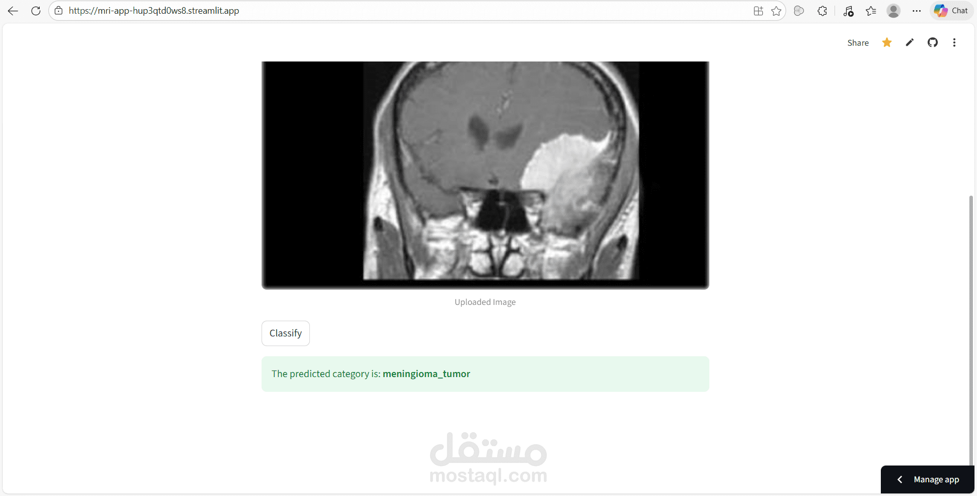 تصنيف صور MRI الى 4 انواع مختلفة بإستخدام Deep Learning Model