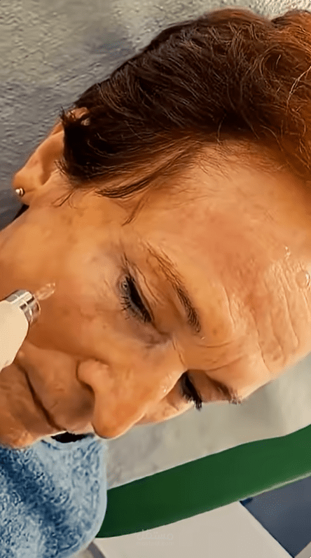 ريلز اعلاني لطبيب تجميل