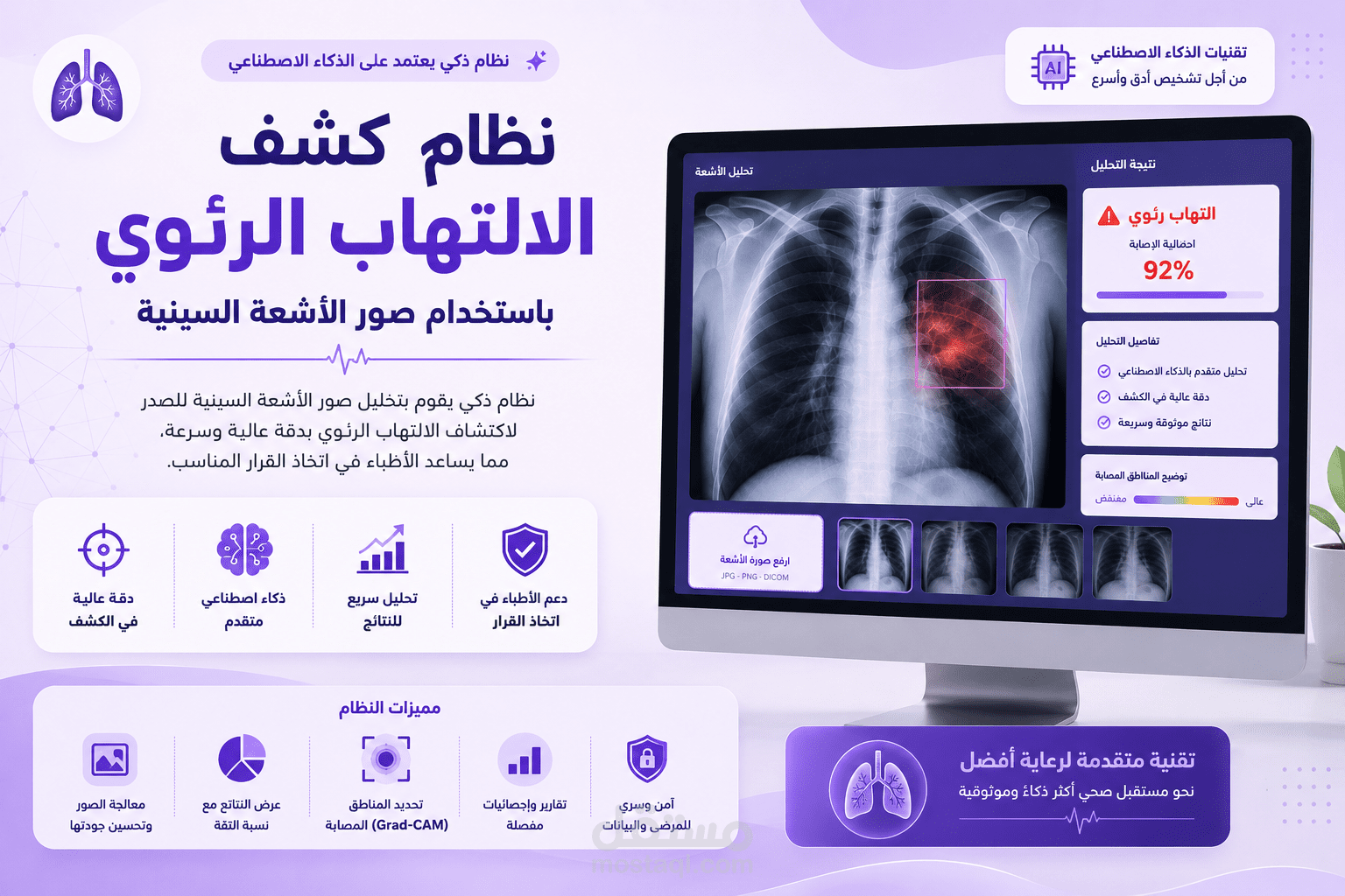 نظام كشف الالتهاب الرئوي باستخدام صور الأشعة السينية (Pneumonia detection system using X-ray images)