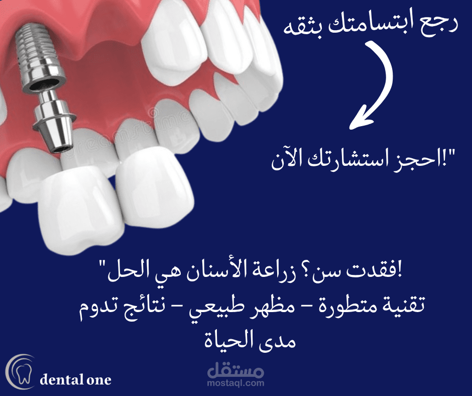 إعلان سوشيال ميديا لزراعة الأسنان | Dental One – Dental Implant Ad (Concept Design)