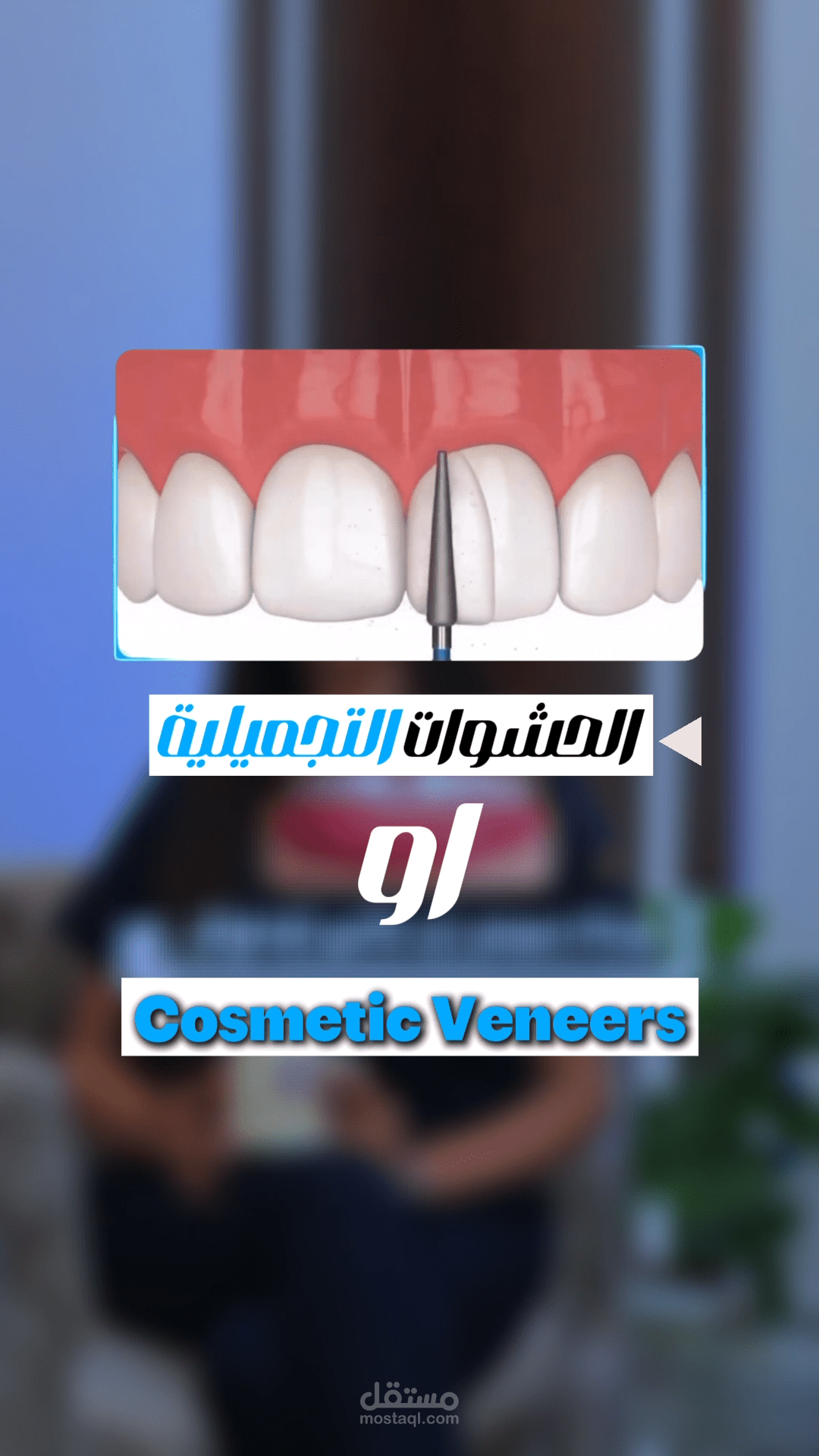 فيديو مونتاج عن الاسنان