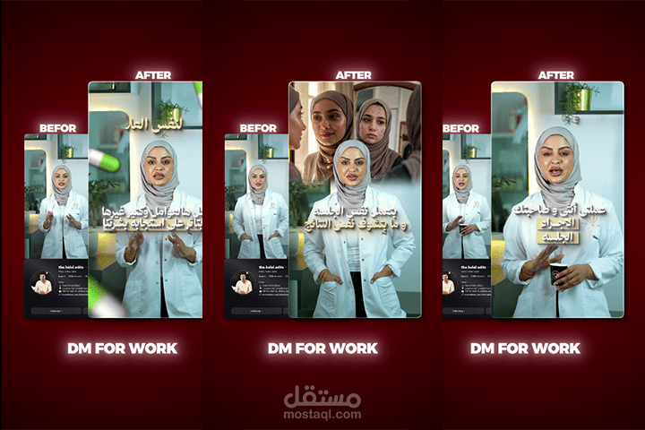 مونتاج فيديو طبي احترافي لطبيبة جلدية | Reels للسوشيال ميديا