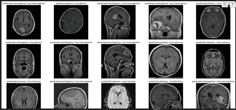 Brain Tumor Classification Using Deep CNN with Residual Blocks