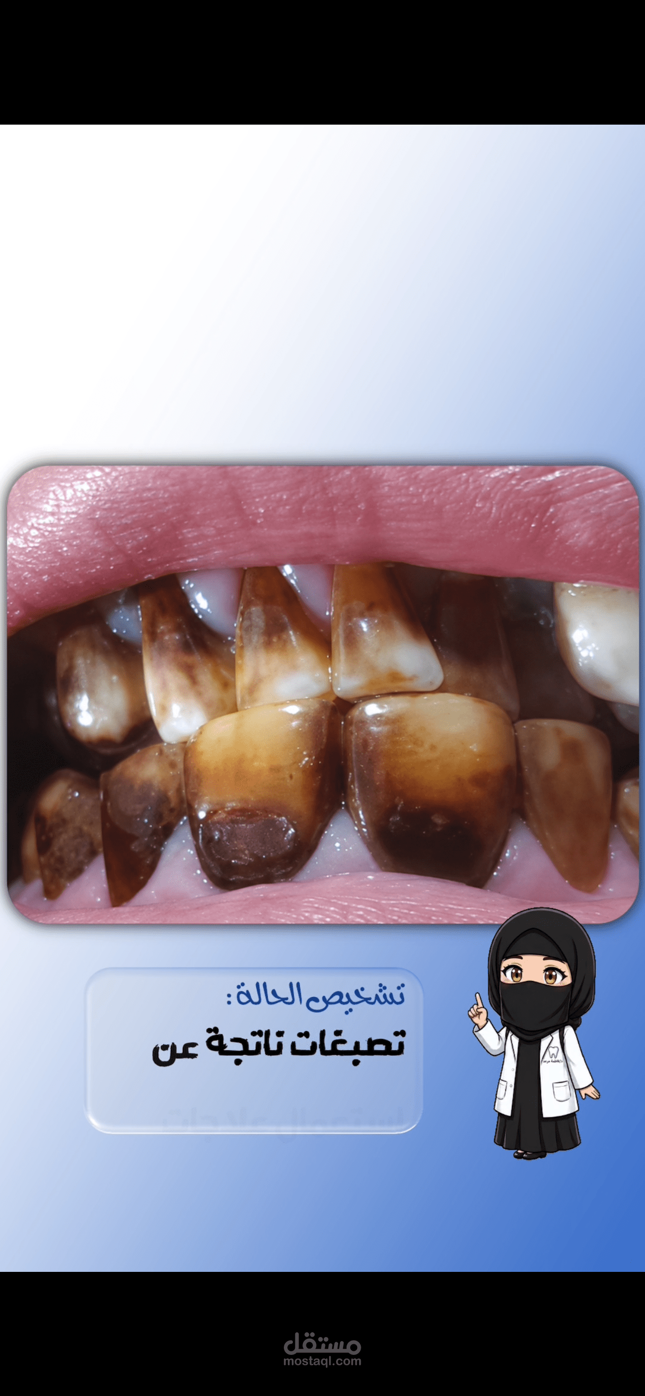 موشن جرافيك ومونتاج لصالح عياده اسنان