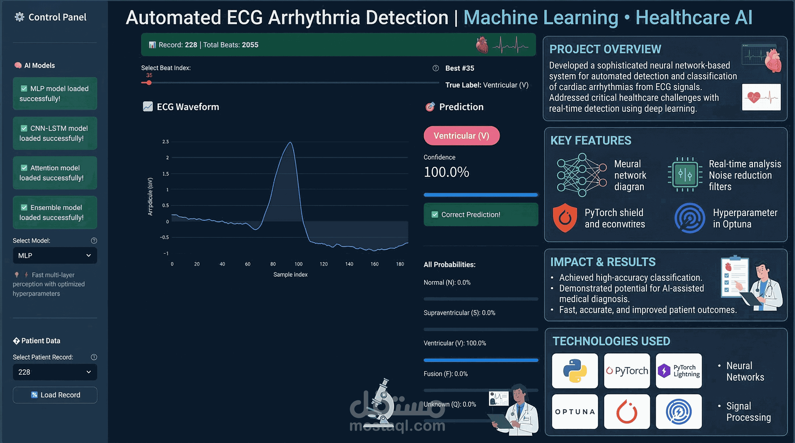 نظام ذكاء اصطناعي للتشخيص الآلي لاضطرابات ضربات القلب (ECG) باستخدام التعلّم العميق.