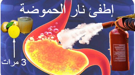 علاج إرتجاع المريئ فى المنزل | مشروبات وأغذية تعالج الحموضة | GERD home remedies
