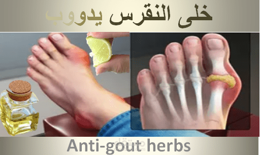 ما لا تعرفه عن النقرس الأسباب والأغذية الممنوعة والعلاج Anti-gout herbs