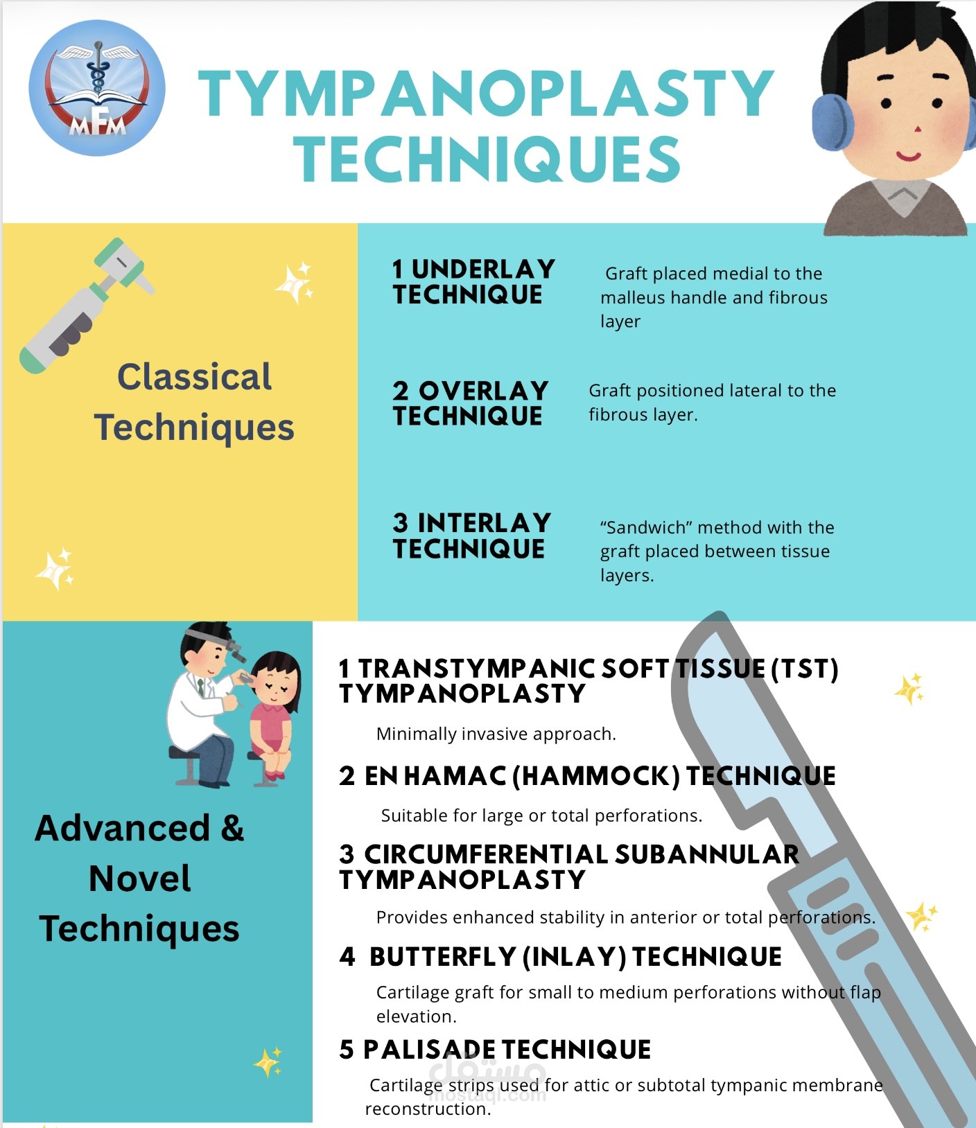 Tympanoplasty techniques poster