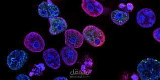 Breast Cancer Diagnosis Prediction
