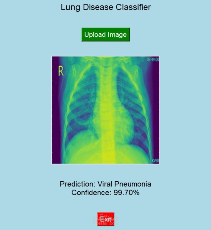 Lung Diseases Prediction