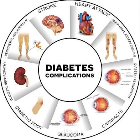 "Diabetes Complications: A Medical Translation Sample"