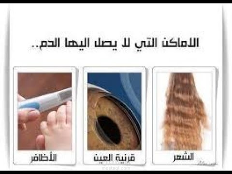 تعليق صوتي